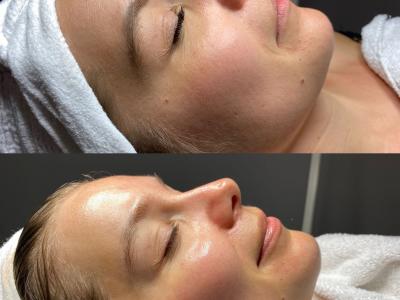 HydroPeptide Collagen Reactivate Treatment Series
