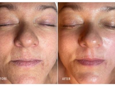 HydroPeptide Collagen Reactivate Treatment Series
