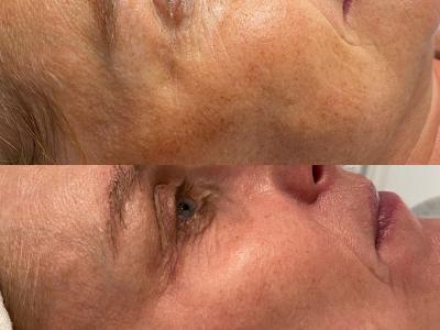 Maak kennis met Skin Care Center