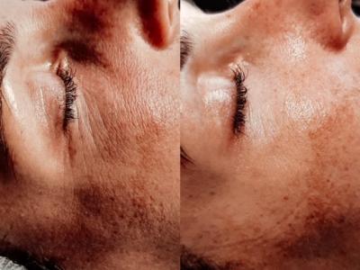 Maak kennis met Skin Care Center