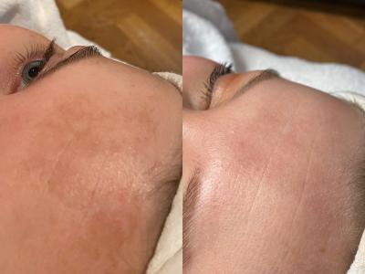 Maak kennis met Skin Care Center