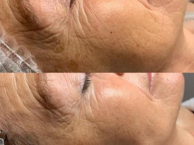 HydroPeptide: Clinical results + luxury experience.