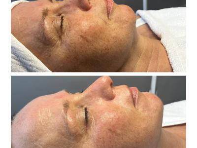 HydroPeptide: Clinical results + luxury experience.