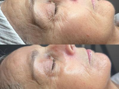 HydroPeptide: Clinical results + luxury experience.