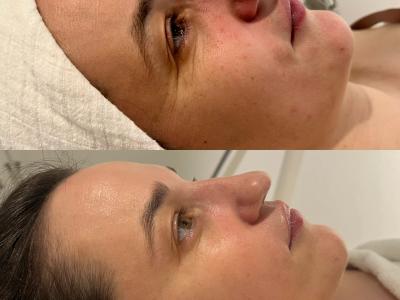 HydroPeptide: Clinical results + luxury experience.