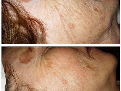 Dermalogica behandelingen