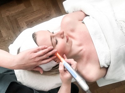 Voor- en nazorg Microneedling