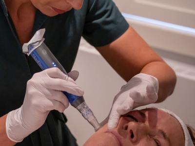 Voor- en nazorg SkinPen Microneedling