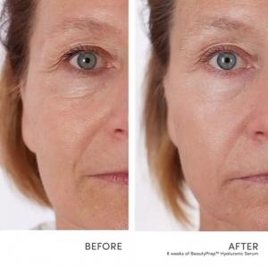 BeautyPrep Hyaluronic Serum
