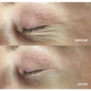 PolyPeptide Collagel+Eye