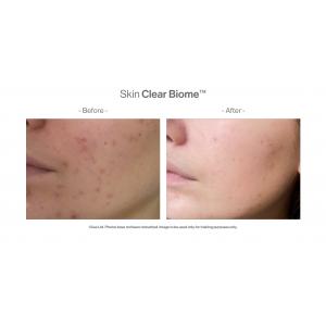 Skin Clear Biome