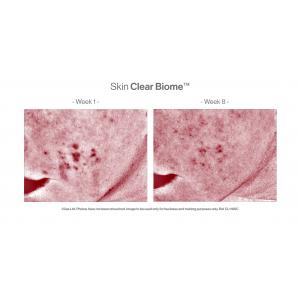 Skin Clear Biome