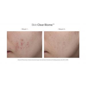 Skin Clear Biome