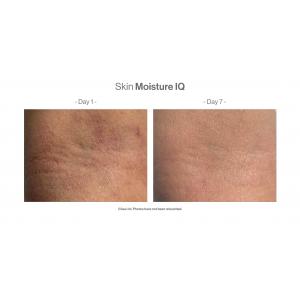 Skin Moisture IQ