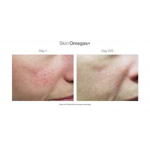 SKIN OMEGAS+
