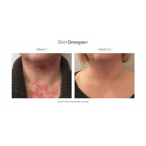 SKIN OMEGAS+