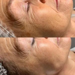 The 12-week Glow Reset - kuur