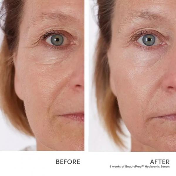 BeautyPrep Hyaluronic Serum
