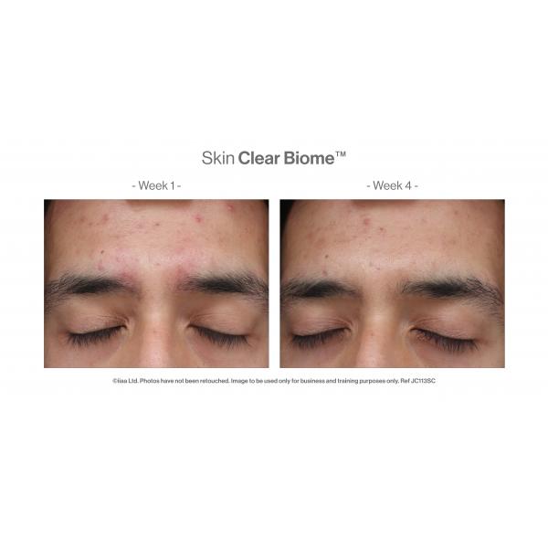 Skin Clear Biome