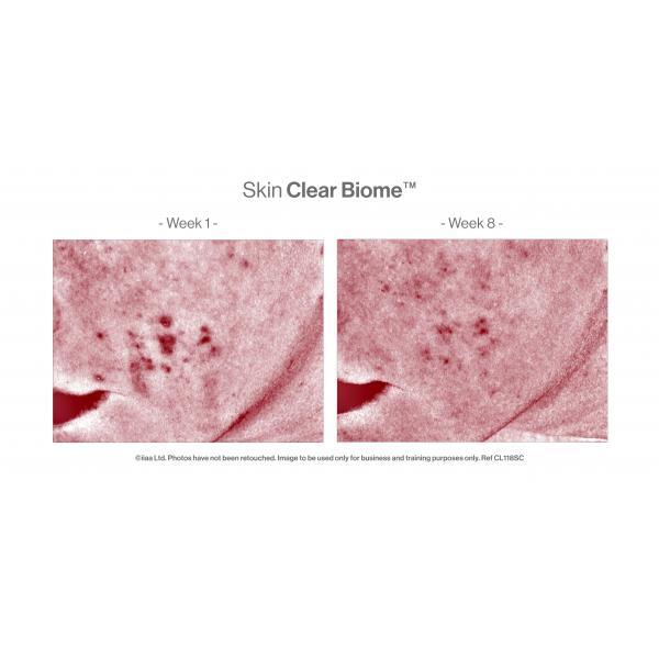 Skin Clear Biome