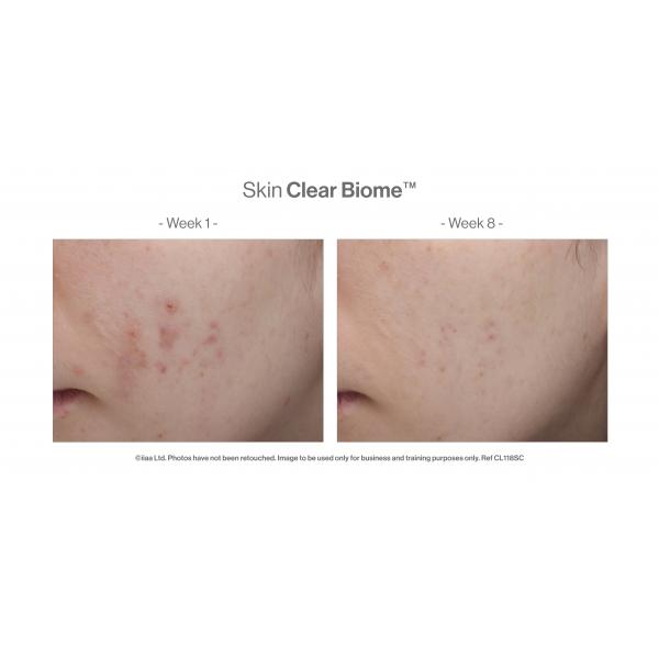 Skin Clear Biome