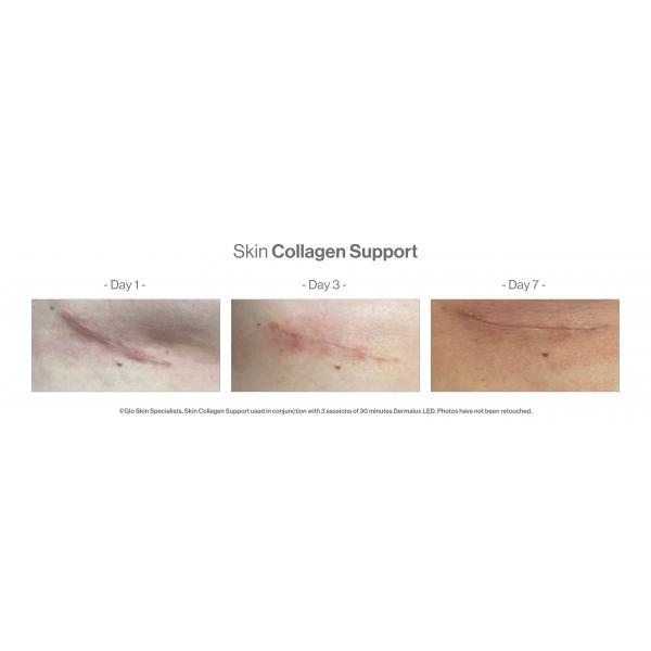 Skin Collagen Support 