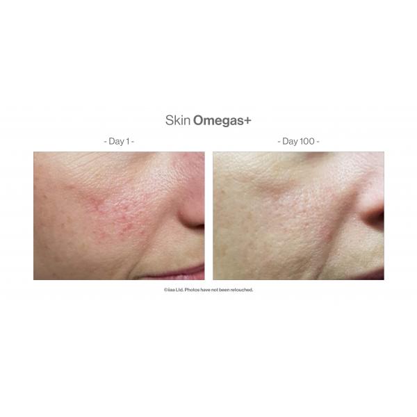 SKIN OMEGAS+