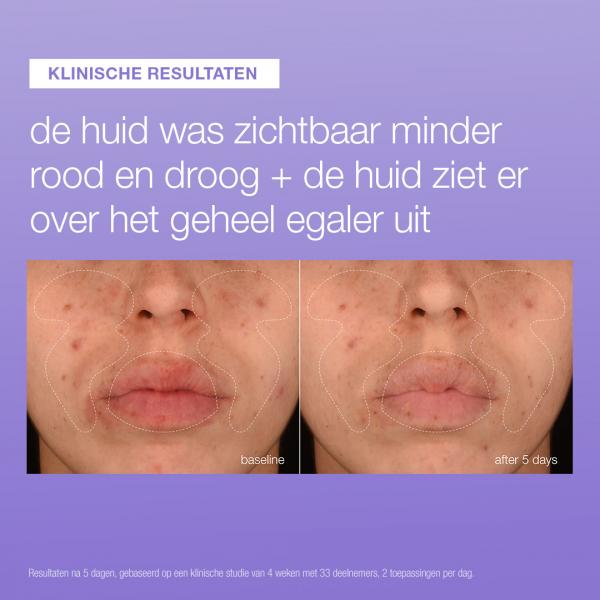 Stabilizing Repair Serum