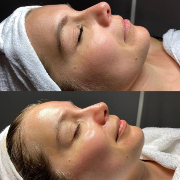 The 12-week Glow Reset - kuur